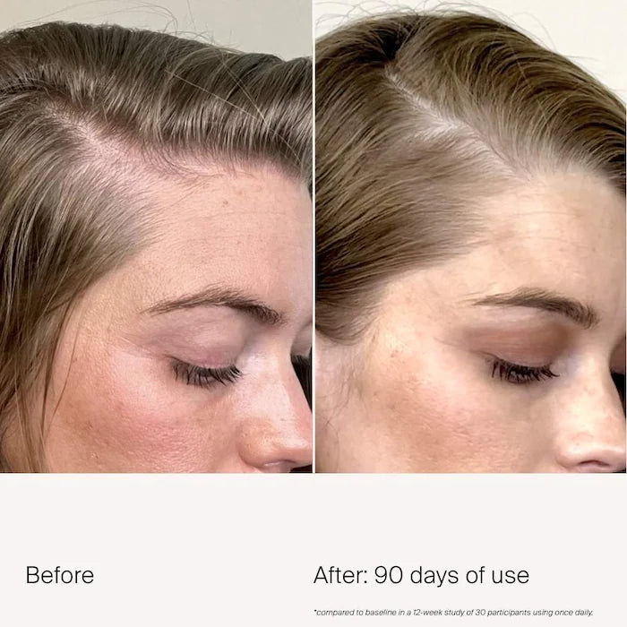 Living Proof® Scalp Care Density Serum for Thinning & Greying Hair